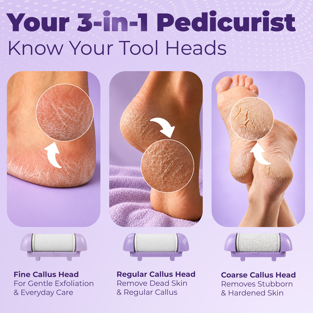 Airluxe Pedismooth Callus Remover for Feet