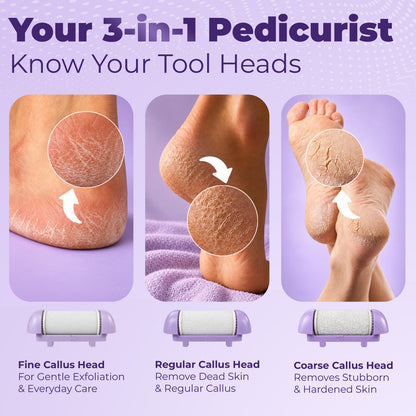 Airluxe Pedismooth Callus Remover for Feet